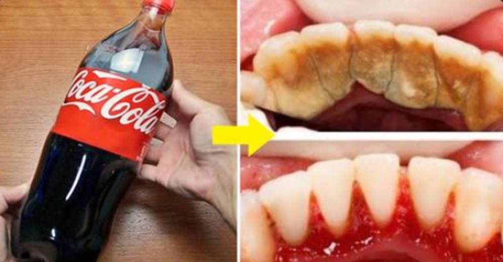 可口可樂這樣用，牙垢自動脫落，5個可口可樂的實用生活技巧，學到就賺到了 - | 點知天下